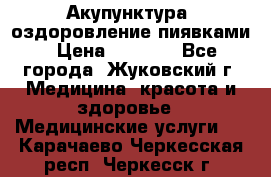 Акупунктура, оздоровление пиявками › Цена ­ 3 000 - Все города, Жуковский г. Медицина, красота и здоровье » Медицинские услуги   . Карачаево-Черкесская респ.,Черкесск г.